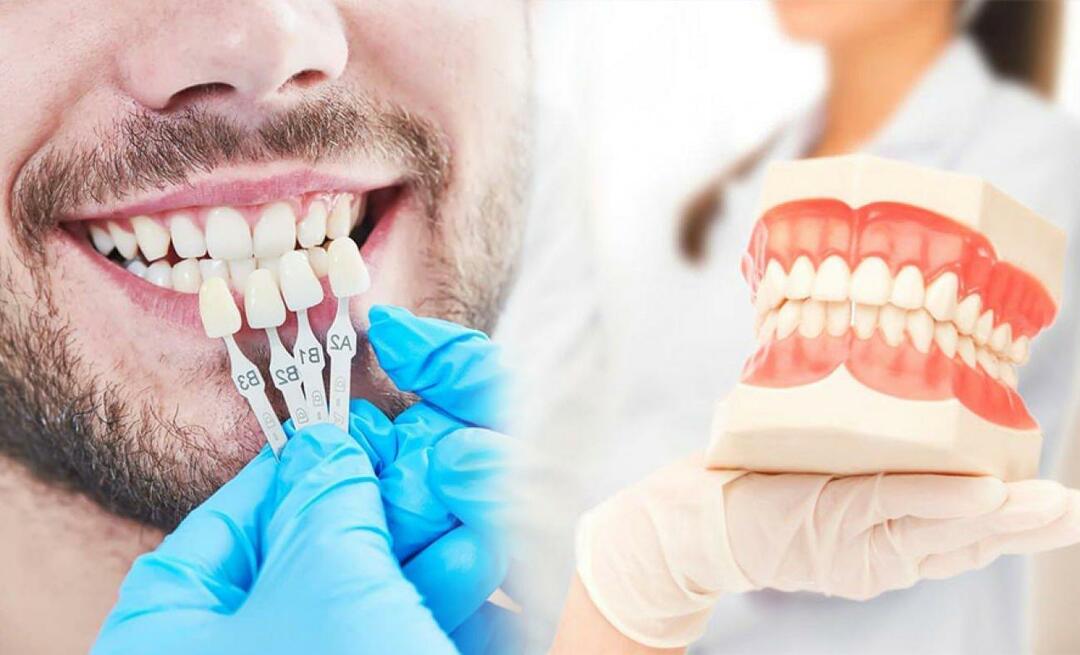 Perché le corone in zirconio vengono applicate ai denti? Quanto dura il rivestimento in zirconio?