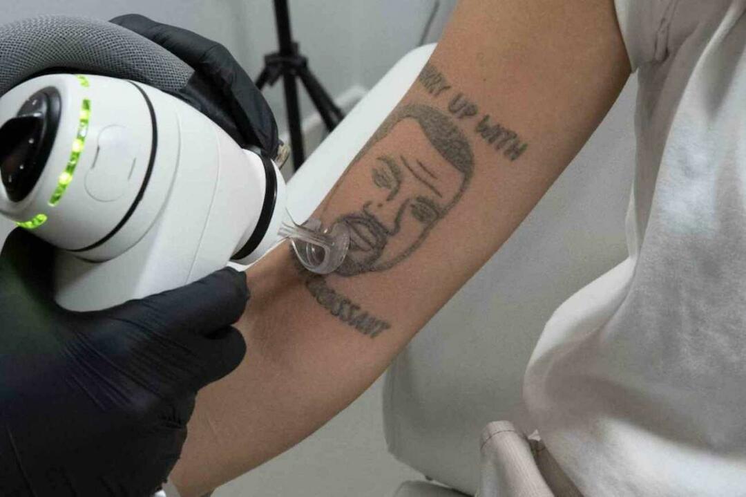 Servizio gigantesco per coloro a cui non piace Kanye West! L'opportunità di rimuovere il suo tatuaggio gratuitamente ha combinato un casino