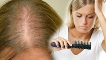 Qual è il metodo più efficace contro la caduta dei capelli? Ricette di maschere che fermano la caduta dei capelli hair