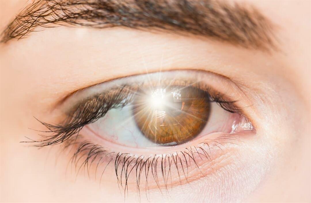 Cosa provoca lampi di luce negli occhi e come viene trattato?