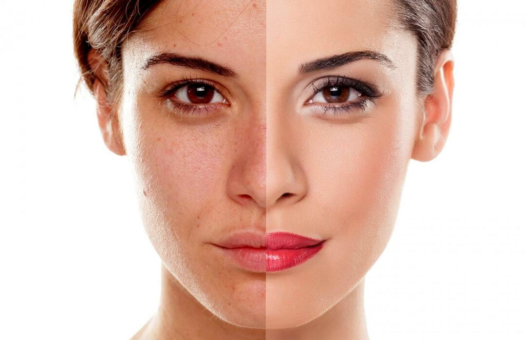 Come possiamo evitare che la pelle appaia stanca? Come ridurre l'aspetto stanco della pelle?