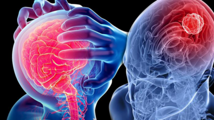 Cos'è la degenerazione del cervelletto (midollo spinale)? Quali sono i sintomi del cervelletto (midollo spinale)?