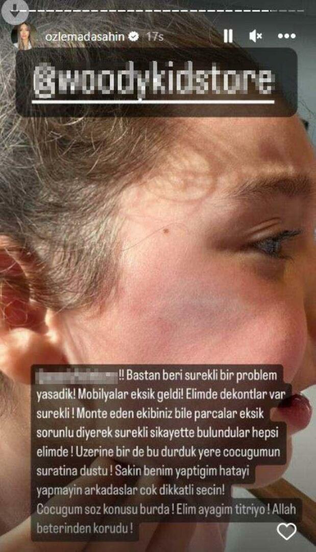 La porta dell'armadio è caduta sul viso della figlia di Berkay Şahin