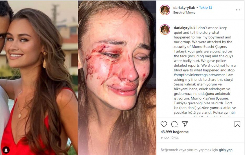 Daria Kyryliuk, che è stata picchiata a İzmir Çeşme, è stata colpita dal coronavirus!