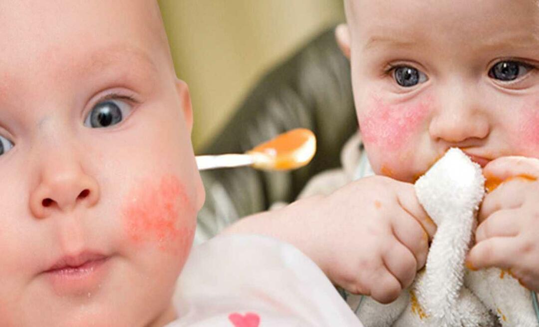 Cosa dovrebbe mangiare un bambino con allergie? Quali sono gli alimenti alternativi per i bambini allergici?
