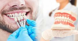 Perché le faccette in zirconio vengono applicate ai denti? Quanto dura il rivestimento in zirconio?