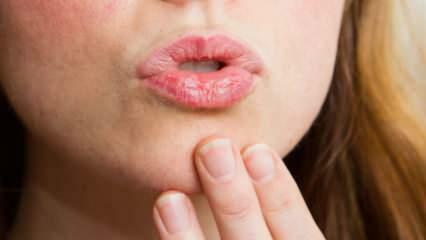 Come fare la cura delle labbra a casa? Facile cura delle labbra secche in 4 passaggi