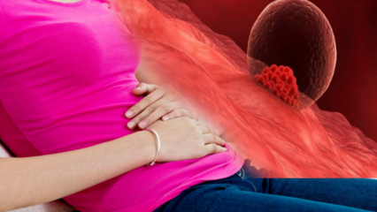 Cos'è il sanguinamento da impianto durante la gravidanza? Come distinguere il sanguinamento da posizionamento dal sanguinamento mestruale