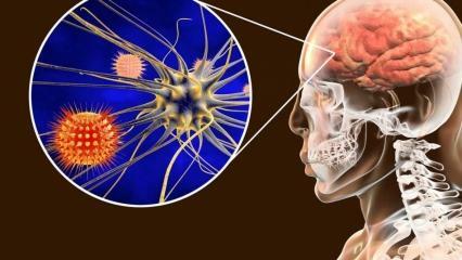 Cos'è la meningite e quali sono i suoi sintomi? Esiste una cura per la meningite?